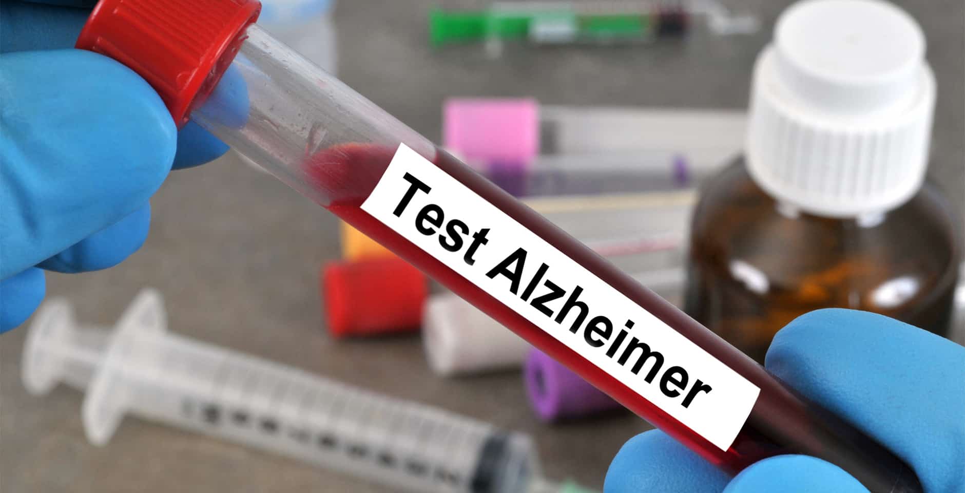 Provrör med blod märkt Test Alzheimer