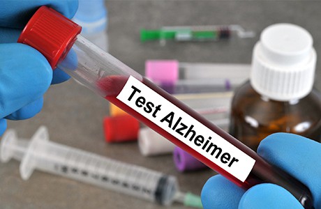 Provrör med blod märkt Test Alzheimer
