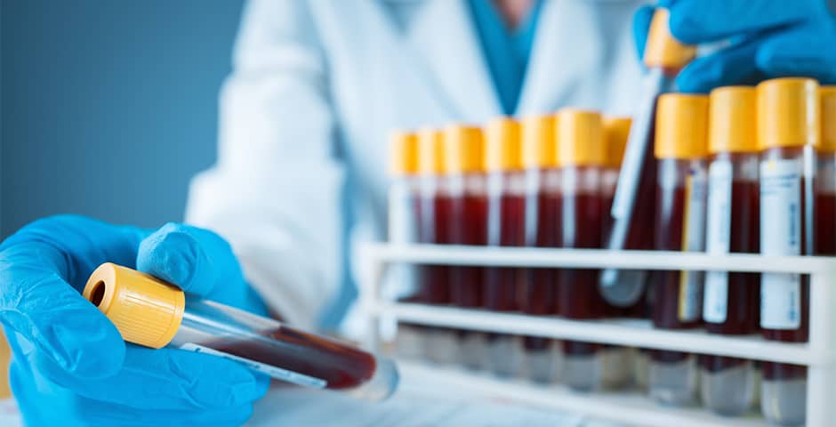 Forskare håller i ett provrör med blod
